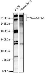 Western blot analysis of various lysates, using Anti-NG2 Antibody (A309698) at 1:1,000 dilution