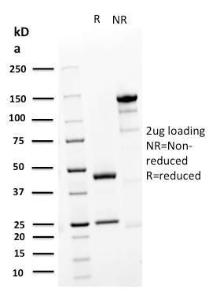 SDS-PAGE analysis of Anti-Desmoglein 3 Antibody [DSG3/2839] under non-reduced and reduced conditions; showing intact IgG and intact heavy and light chains, respectively SDS-PAGE analysis confirms the integrity and purity of the antibody