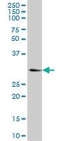 Anti-KHK Mouse Monoclonal Antibody [clone: S1]