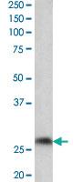 Anti-PTGDS Goat Polyclonal Antibody