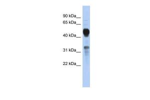 Anti-MVK Rabbit Polyclonal Antibody