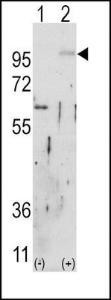 Anti-FGFR2 Rabbit Polyclonal Antibody