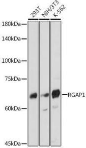 Western blot analysis of extracts of various cell lines, using Anti-RACGAP1/MGCRACGAP Antibody [ARC2394] (A307175) at 1:1000 dilution. The secondary Antibody was Goat Anti-Rabbit IgG H&L Antibody (HRP) at 1:10000 dilution. Lysates/proteins were present at 25 µg per lane