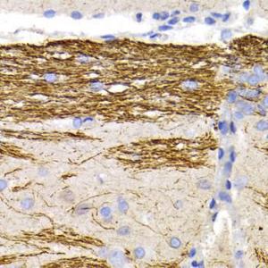 Immunohistochemistry analysis of paraffin-embedded rat brain using Anti-68kDa Neurofilament/NF-L Antibody (A12580) at a dilution of 1:200 (40x lens) Perform microwave antigen retrieval with 10 mM PBS buffer pH 72 before commencing with IHC staining protocol