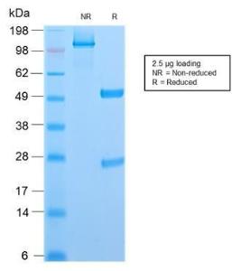 SDS-PAGE analysis of Anti-CD6 Antibody [C6/2884R] under non-reduced and reduced conditions; showing intact IgG and intact heavy and light chains, respectively SDS-PAGE analysis confirms the integrity and purity of the antibody