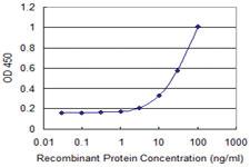 Anti-PMS2 Mouse Monoclonal Antibody [clone: 4D11]