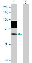 Anti-SSH6 Rabbit Polyclonal Antibody