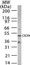 Anti-CXCR4 Rabbit Polyclonal Antibody