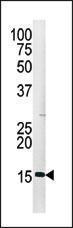 Anti-HIST3H3 Rabbit polyclonal antibody