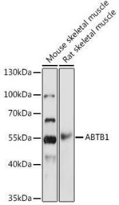 Anti-BPOZ/ABTB1 Rabbit Polyclonal Antibody