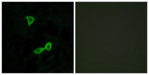 Immunofluorescence analysis of LOVO cells using Anti-GRM2 Antibody. The right hand panel represents a negative control, where the antibody was pre-incubated with the immunising peptide.