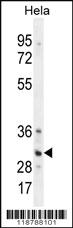 Anti-TRADD Rabbit Polyclonal Antibody