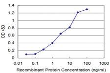 Anti-NEUROG3 Mouse Monoclonal Antibody [clone: 4F9]