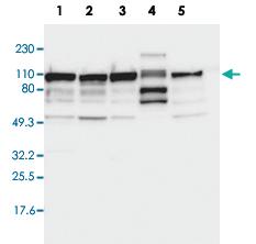 Anti-CTAGE5 Rabbit Polyclonal Antibody