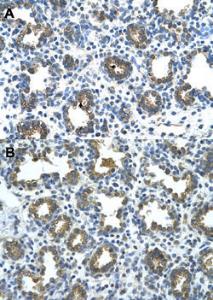 Anti-GUSB Rabbit Polyclonal Antibody