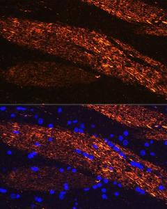 Immunofluorescence analysis of rat brain using Anti-68kDa Neurofilament/NF-L Antibody (A12580) at a dilution of 1:100 (40x lens) DAPI was used to stain the cell nuclei (blue)