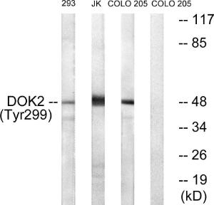 Western blot analysis of lysates from COS7 cells treated with insulin 0.01 U/ml 15', Jurkat cells treated with insulin 0.01 U/ml 15' and 293 cells treated with serum 20% 15' using Anti-p56 Dok-2 (phospho Tyr299) Antibody.