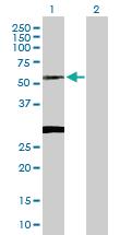 Anti-CLN3 Rabbit Polyclonal Antibody