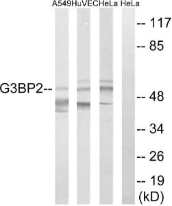 Western blot analysis of lysates from HeLa, HUVEC, and A549 cells using Anti-G3BP2 Antibody. The right hand lane represents a negative control, where the antibody is blocked by the immunising peptide