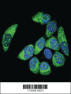 Anti-WT1 Rabbit Polyclonal Antibody