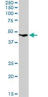 Anti-CLN3 Rabbit Polyclonal Antibody