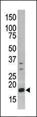 Anti-HIST3H3 Rabbit Polyclonal Antibody (AP (Alkaline Phosphatase))