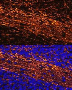 Immunofluorescence analysis of mouse brain using Anti-68kDa Neurofilament/NF-L Antibody (A12580) at a dilution of 1:100 (40x lens) DAPI was used to stain the cell nuclei (blue)