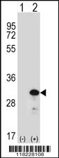 Anti-HMGB2 Rabbit Polyclonal Antibody