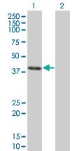 Anti-CLN3 Mouse Monoclonal Antibody [clone: 1G10]