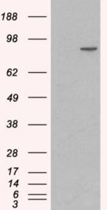 HEK293 overexpressing Human CTNNA1 (RC201766) and probed with EB07242 (mock transfection in first lane), tested by Origene.