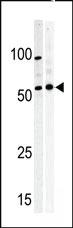 Anti-PKMYT1 Rabbit Polyclonal Antibody