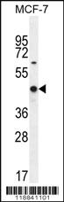 Anti-WT1 Rabbit Polyclonal Antibody