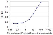 Anti-CLN3 Mouse Monoclonal Antibody [clone: 1G10]