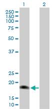 Anti-IL25 Mouse Polyclonal Antibody