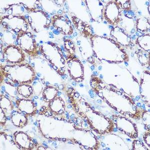 Immunohistochemistry analysis of paraffin-embedded mouse kidney using Anti-NM23A Antibody (A12581) at a dilution of 1:100 (40X lens). Perform microwave antigen retrieval with 10 mM PBS buffer pH 7.2 before commencing with IHC staining protocol