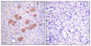 Immunohistochemical analysis of paraffin-embedded human ovary using Anti-p40 phox (phospho Thr154) Antibody. The right hand panel represents a negative control, where the antibody was pre-incubated with the immunising peptide.