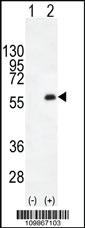 Anti-PKMYT1 Rabbit Polyclonal Antibody