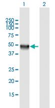 Anti-CLN5 Mouse Polyclonal Antibody