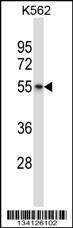 Anti-AVPR1B Rabbit Polyclonal Antibody (HRP (Horseradish Peroxidase))