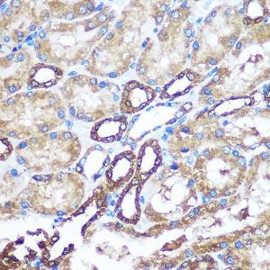 Immunohistochemistry analysis of paraffin-embedded rat kidney using Anti-NM23A Antibody (A12581) at a dilution of 1:100 (40X lens). Perform microwave antigen retrieval with 10 mM PBS buffer pH 7.2 before commencing with IHC staining protocol