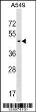 Anti-AGPAT5 Rabbit Polyclonal Antibody (PE (Phycoerythrin))