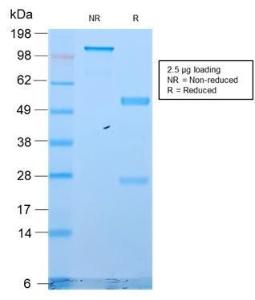 SDS-PAGE analysis of Anti-Cytokeratin 18 Antibody [KRT18/2819R] under non-reduced and reduced conditions; showing intact IgG and intact heavy and light chains, respectively. SDS-PAGE analysis confirms the integrity and purity of the antibody