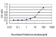 Anti-FOXF2 Mouse Monoclonal Antibody [clone: 3F5]