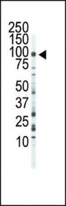 Anti-FGFR3 Rabbit Polyclonal Antibody (Biotin)