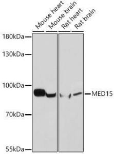 Anti-PCQAP / MED15 Rabbit Polyclonal Antibody