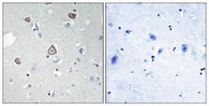 Immunohistochemical analysis of paraffin-embedded human brain tissue using Anti-GRM2 Antibody. The right hand panel represents a negative control, where the antibody was pre-incubated with the immunising peptide.