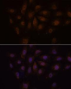 Anti-PCQAP / MED15 Rabbit Polyclonal Antibody