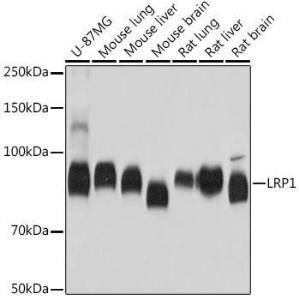 Western blot analysis of extracts of various cell lines, using Anti-LRP1 Antibody [ARC0275] (A308211) at 1:5,000 dilution. The secondary antibody was Goat Anti-Rabbit IgG H&L Antibody (HRP) at 1:10,000 dilution.