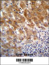 Anti-DPEP3 Rabbit Polyclonal Antibody