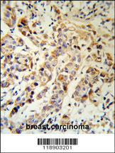 Anti-KRT13 Rabbit Polyclonal Antibody